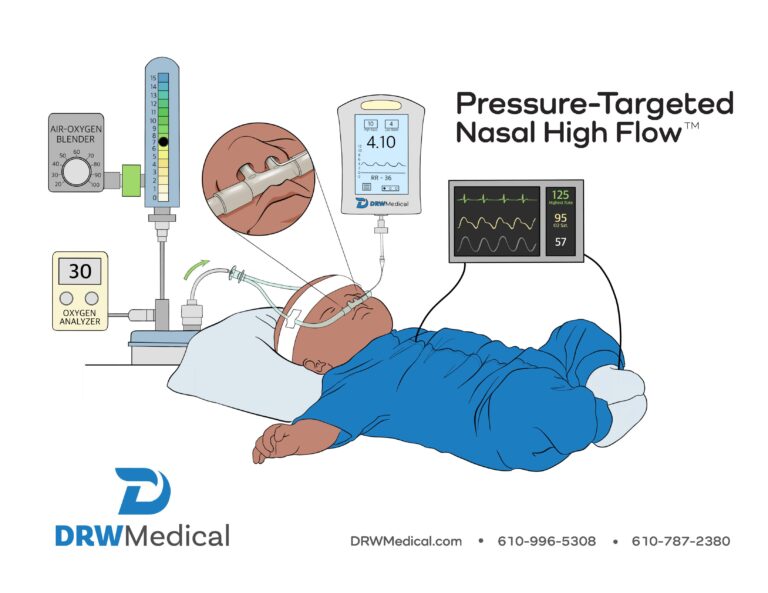Read more about the article DRW Medical – Pressure-Treated Nasal High Flow