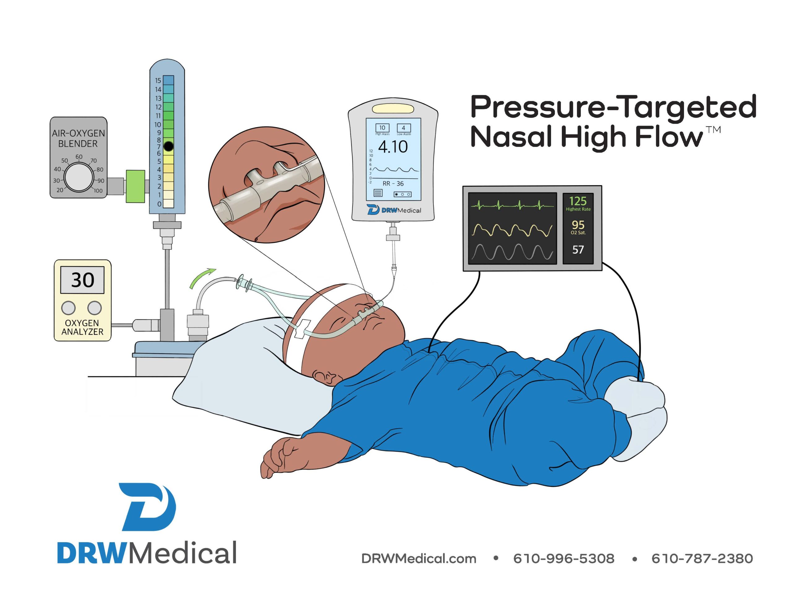 You are currently viewing DRW Medical – Pressure-Treated Nasal High Flow